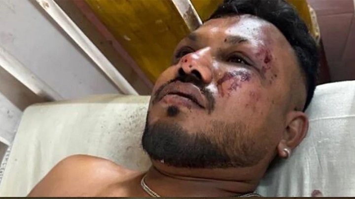 বিধ্বস্ত সেই উড়োজাহাজ থেকে হেঁটে বের হলেন এক যুবক